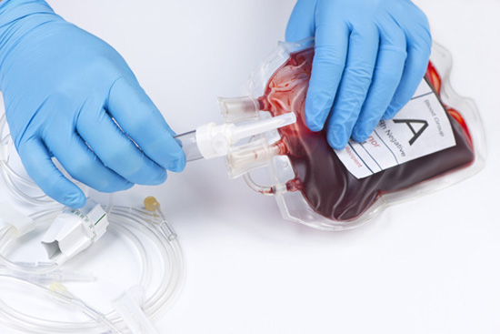 LA TRANSFUSION LA TRANSFUSION